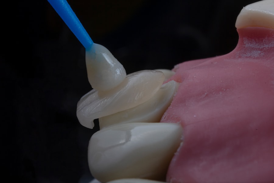 Photo dental implants
