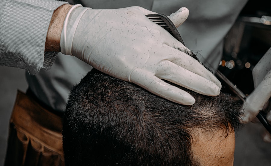 hair loss clinical trials