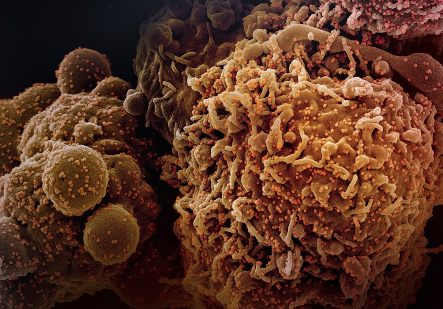 prostate cancer clinical trials