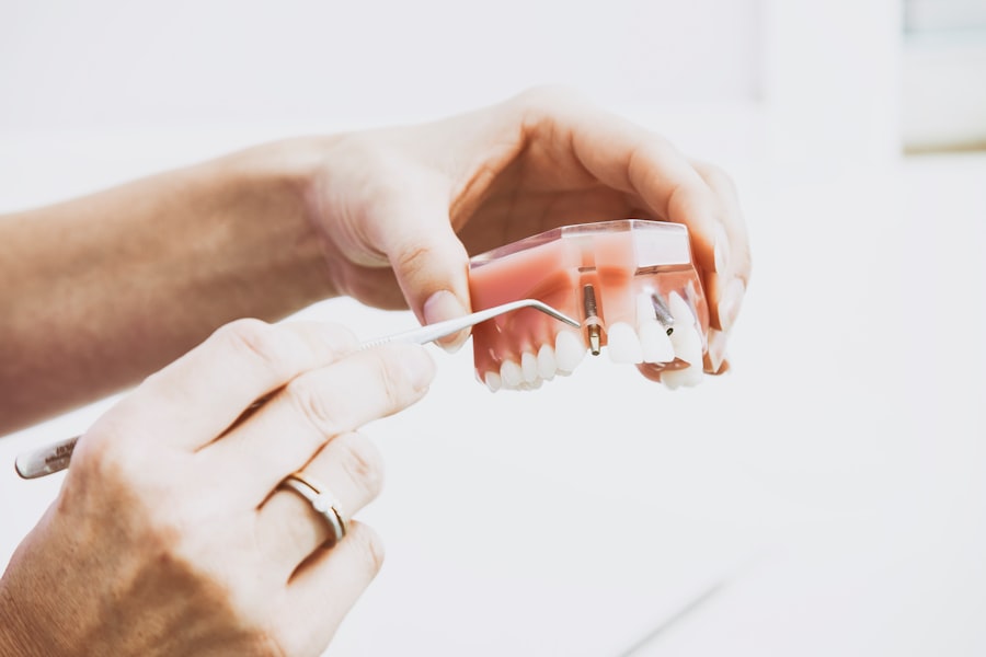 dental implants clinical trials