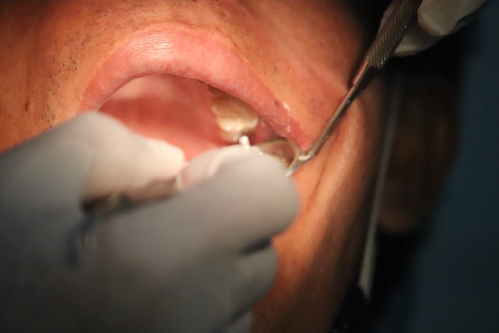 Photo dental implants clinical trials