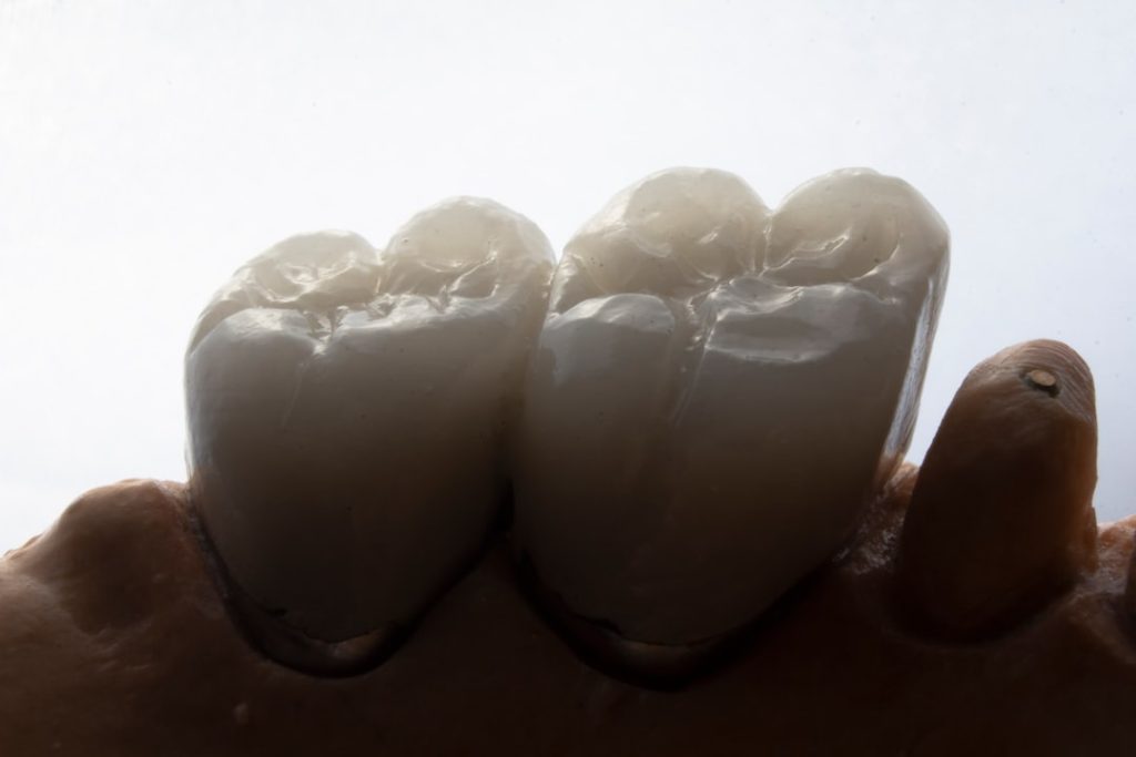 Photo dental implants clinical trials