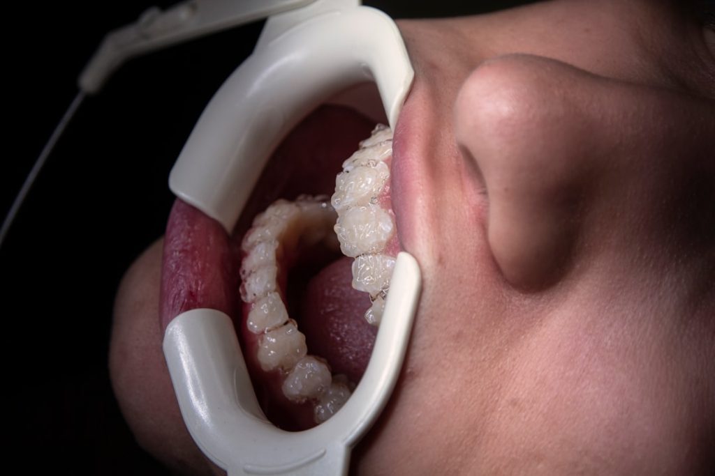 Photo dental implants clinical trials